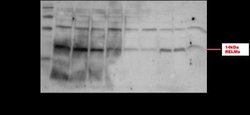 FIZZ1/RELM alpha Antibody - BSA Free, Novus Biologicals 0.025 mg | Buy Online | Novus Biologicals | Fisher Scientific