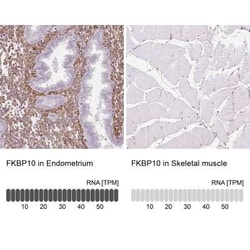 FKBP10 Antibody, Novus Biologicals 25 &mu;L, Unconjugated:Antibodies, Polyclonal
