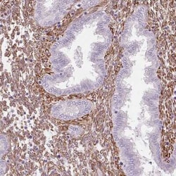 FKBP10 Antibody, Novus Biologicals 25 &mu;L, Unconjugated:Antibodies, Polyclonal