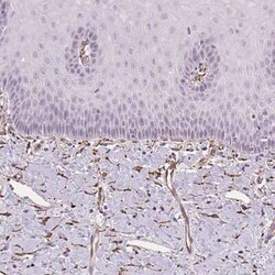 FKBP10 Antibody, Novus Biologicals 25 &mu;L, Unconjugated:Antibodies, Polyclonal
