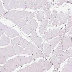 FKBP10 Antibody, Novus Biologicals 25 &mu;L, Unconjugated:Antibodies, Polyclonal