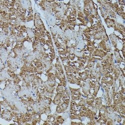 Enolase 1 Rabbit anti-Human, Mouse, Rat, Polyclonal, Novus Biologicals