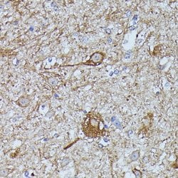 Protein Disulfide Isomerase/P4HB Rabbit anti-Human, Mouse, Rat, Polyclonal,