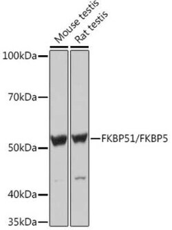 FKBP51/FKBP5 Rabbit anti-Human, Mouse, Rat, Clone: 7W2R1, Novus Biologicals