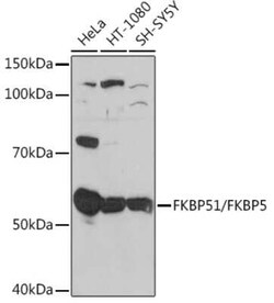 FKBP51/FKBP5 Rabbit anti-Human, Mouse, Rat, Clone: 7W2R1, Novus Biologicals