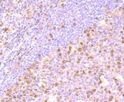 FKBP51/FKBP5 Rabbit anti-Human, Rat, Clone: JB95-39, Novus Biologicals