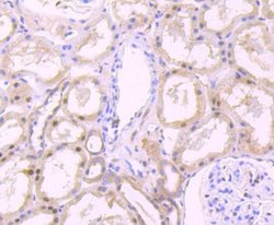 FKBP51/FKBP5 Rabbit anti-Human, Rat, Clone: JB95-39, Novus Biologicals