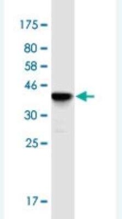 FKBP6 Antibody (8F10), Novus Biologicals 100 &mu;g | Buy Online | Novus Biologicals | Fisher Scientific