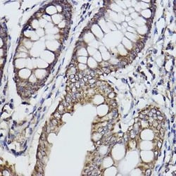 FKTN Rabbit anti-Human, Mouse, Rat, Clone: 7J5N6, Novus Biologicals:Antibodies:Primary