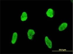 FLI1 Antibody (1G8), Novus Biologicals 0.1 mg, Unconjugated:Antibodies,