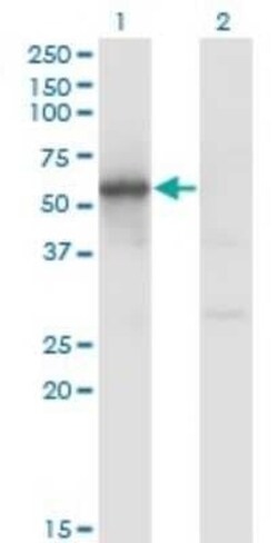 FLI1 Antibody (1G8), Novus Biologicals 0.1 mg, Unconjugated:Antibodies,