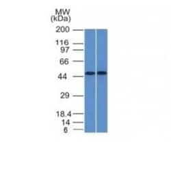 FLI1 Antibody (FLI1/1312), Novus Biologicals 100&mu;g; Unlabeled:Antibodies,