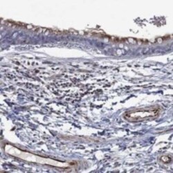 FLI1 Rabbit anti-Human, Polyclonal, Novus Biologicals:Antibodies:Primary