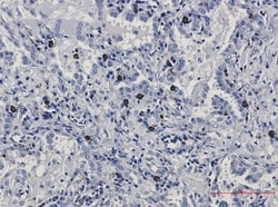 FLI1 Antibody (S01-0C2), Novus Biologicals:Antibodies:Primary Antibodies