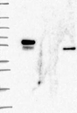 FLI1 Rabbit anti-Human, Polyclonal, Novus Biologicals:Antibodies:Primary