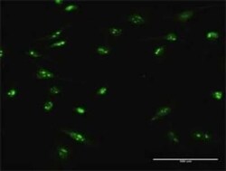 FLJ11184 Antibody, Novus Biologicals 0.1 mg | Buy Online | Novus Biologicals | Fisher Scientific