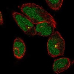 FLJ13946 Antibody, Novus Biologicals:Antibodies:Primary Antibodies