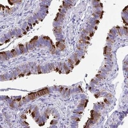FLJ13946 Antibody, Novus Biologicals:Antibodies:Primary Antibodies