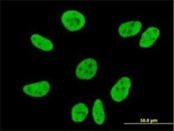 VPS50 Antibody (2D11), Novus Biologicals 100 &mu;g | Buy Online | Novus Biologicals | Fisher Scientific