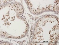VPS50 Antibody (2D11), Novus Biologicals 100 &mu;g | Buy Online | Novus Biologicals | Fisher Scientific