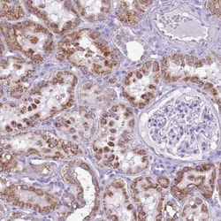 FLJ21963 Antibody, Novus Biologicals 25 &mu;L, Unconjugated:Antibodies,
