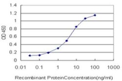 POMK/SGK196 Antibody (6F10), Novus Biologicals 0.1 mg; Unconjugated:Antibodies,