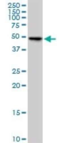 POMK/SGK196 Antibody (6F10), Novus Biologicals 0.1 mg; Unconjugated:Antibodies,