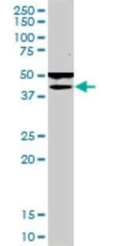 POMK/SGK196 Antibody (6F10), Novus Biologicals 0.1 mg; Unconjugated:Antibodies,