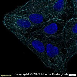 FLNC Antibody - BSA Free, Novus Biologicals 0.025 mg; Unconjugated:Antibodies,
