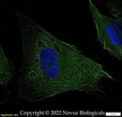 FLNC Antibody - BSA Free, Novus Biologicals 0.025 mg; Unconjugated:Antibodies,