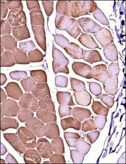 FLNC Antibody - BSA Free, Novus Biologicals 0.1 mg; Unconjugated:Antibodies,