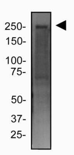 FLNC Antibody - BSA Free, Novus Biologicals 0.1 mg; Unconjugated:Antibodies,