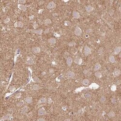 FLRT1 Antibody, Novus Biologicals 0.1 mL, Unconjugated:Antibodies, Polyclonal