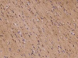 FLRT1 Antibody, Novus Biologicals 100 &mu;g | Buy Online | Novus Biologicals | Fisher Scientific