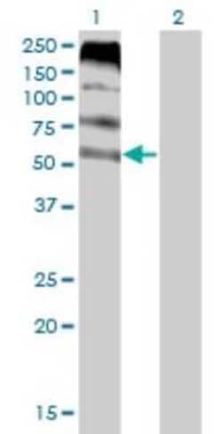 Novus Biologicals FLVCR Antibody (4B2), Novus Biologicals 0.1 mg | Buy Online | Novus Biologicals&trade; | Fisher Scientific