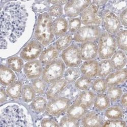 FMO1 Rabbit anti-Human, Polyclonal, Novus Biologicals:Antibodies:Primary