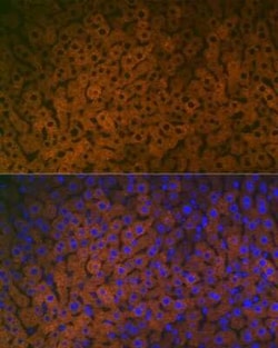 FMO3 Rabbit anti-Human, Mouse, Rat, Clone: 6Q10X9, Novus Biologicals 100
