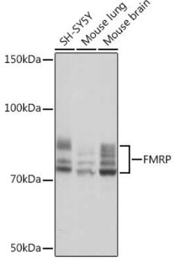 FMRP Rabbit anti-Human, Mouse, Rat, Clone: 4Y8I5, Novus Biologicals 20 &mu;g | Buy Online | Novus Biologicals | Fisher Scientific