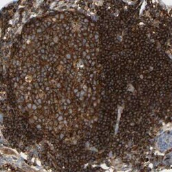 FNBP1 Antibody, Novus Biologicals 0.1 mL, Unconjugated:Antibodies, Polyclonal