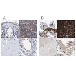 FNBP1 Antibody, Novus Biologicals 100 &mu;g; Unconjugated:Antibodies, Polyclonal