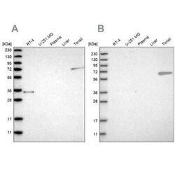 FNBP1 Antibody, Novus Biologicals 0.1 mL, Unconjugated:Antibodies, Polyclonal