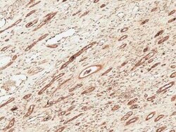 FNIP1 Antibody, Novus Biologicals 100 &mu;g | Buy Online | Novus Biologicals | Fisher Scientific