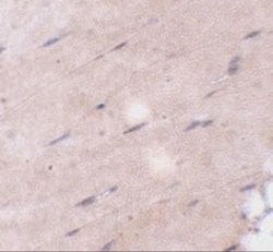 FNIP2 Antibody - BSA Free, Novus Biologicals 0.1 mg; Unconjugated:Antibodies,