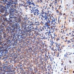 FNTB Rabbit anti-Human, Rat, Clone: 3I4X5, Novus Biologicals:Antibodies:Primary