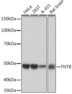 FNTB Rabbit anti-Human, Rat, Clone: 3I4X5, Novus Biologicals:Antibodies:Primary