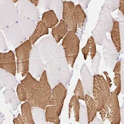 FOCAD Antibody, Novus Biologicals 0.1 mL, Unconjugated:Antikörper