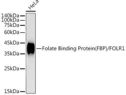 FOLR1 Rabbit anti-Human, Mouse, Rat, Clone: 3J6W3, Novus Biologicals 20