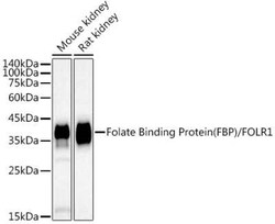 FOLR1 Rabbit anti-Human, Mouse, Rat, Clone: 3J6W3, Novus Biologicals 20