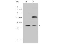 FOLR2 Antibody, Novus Biologicals:Antibodies:Primary Antibodies