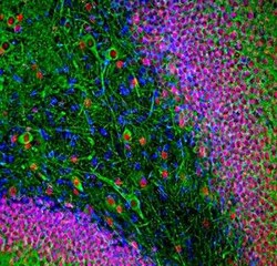 FOX2 Antibody, Novus Biologicals 100 &mu;g; Unconjugated:Antibodies, Polyclonal